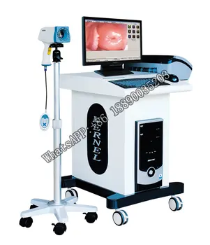 Цифровой портативный кольпоскоп с автофокусировкой, Видеоэндоскопическая кольпоскопия, клиническая гинекология, видеоэндоскоп